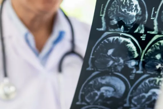Novartis Medhub is a healthcare professionals resource Neurology results being viewed